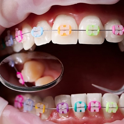 What to Expect from the Best Orthodontists in Dubai