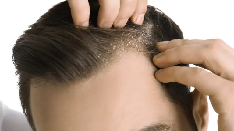 What Are The Causes and the Cures Behind Hair Thinning?