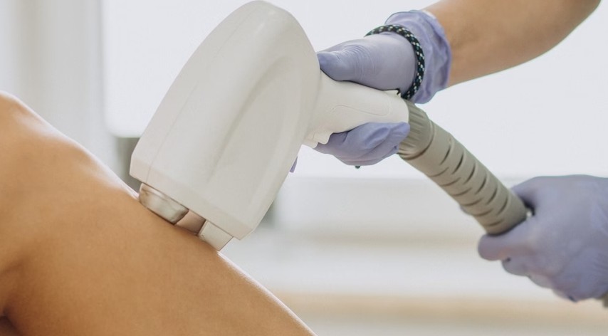 Laser Hair Removal in Dehradun: What to Expect