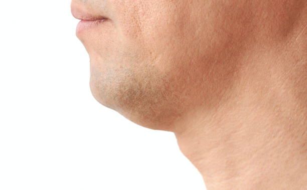 Neck lift surgery in Abu Dhabi