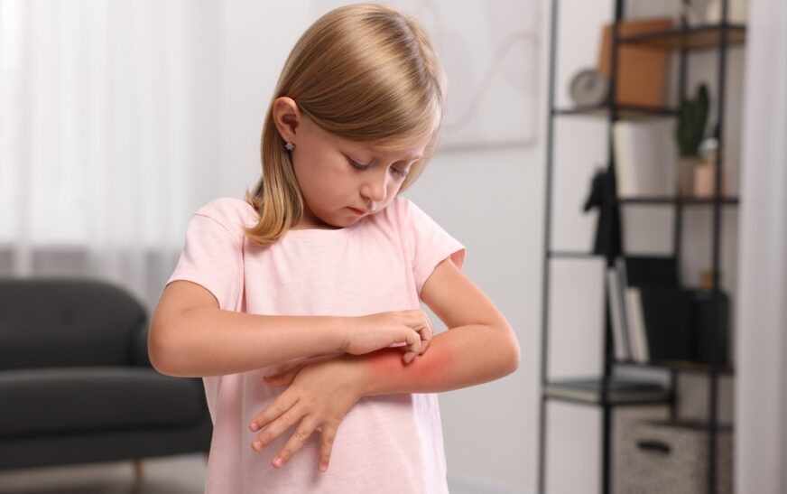 Blanching Rash Causes in Children