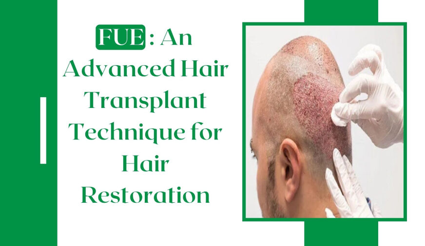 FUE Hair Transplant in Delhi - DMC Trichology