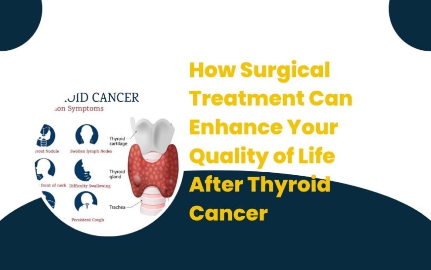 Surgical Treatment for Thyroid Cancer