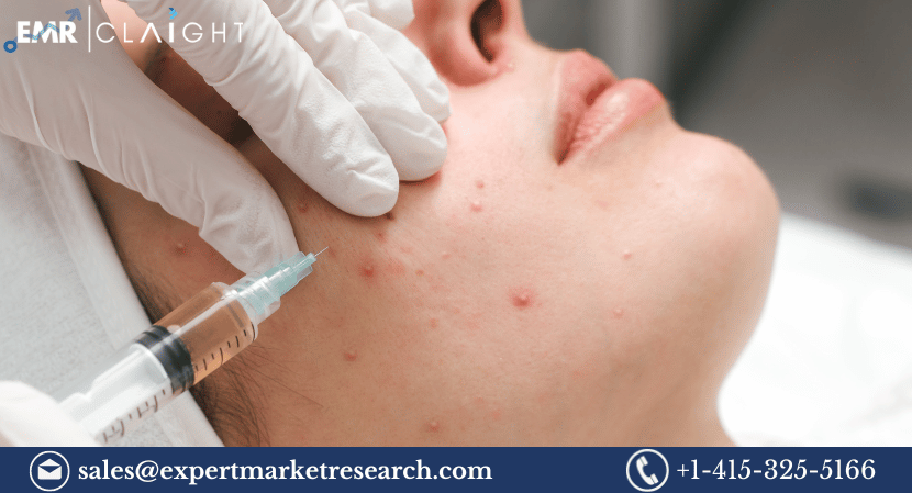 Global Severe Acne Vulgaris Treatment Market Size, Share, Trends, Growth, Analysis, Report and Forecast 2024-2032