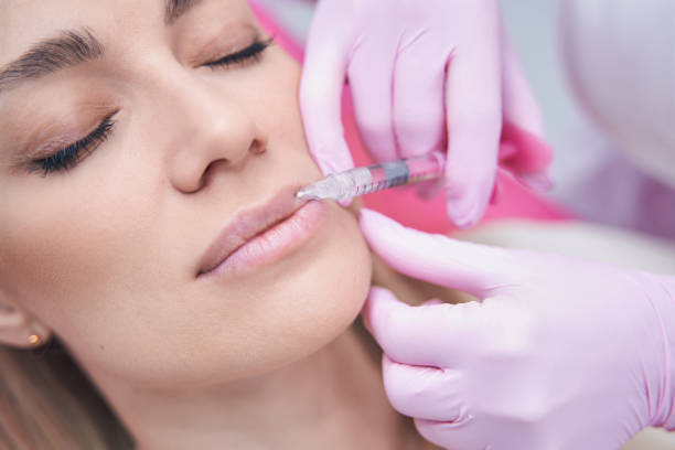 Long-Lasting Lip Fillers Injection in Abu Dhabi