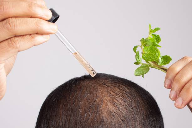 Crown Hair Transplant: Personalized Consultations in Abu Dhabi